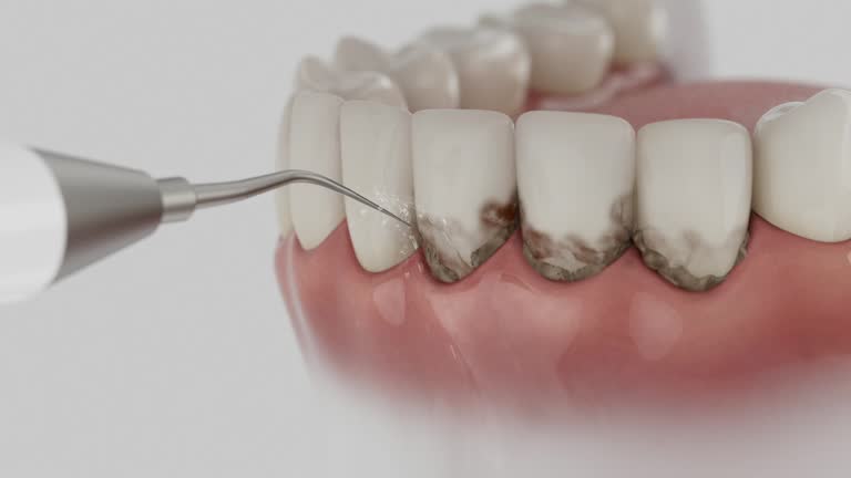 Reliable Dental contractor in Los Altos, CA by Dentist Open Now